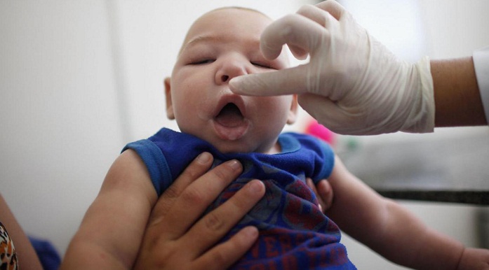 WHO dispels 4 biggest rumors about Zika and microcephaly